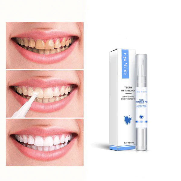 Fast At Home Teeth Whitening Kit - BritishElegance