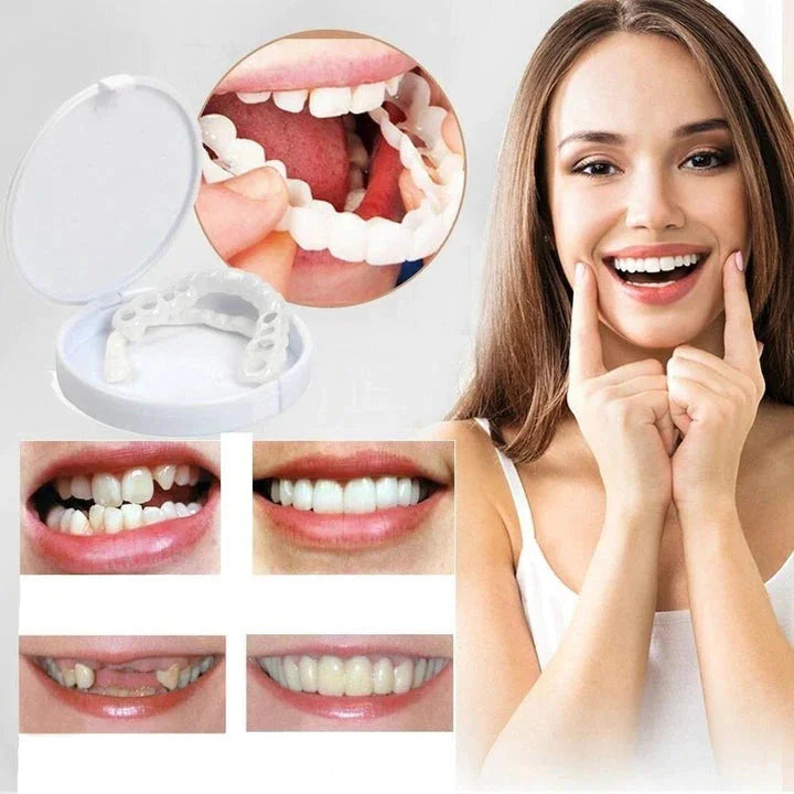 Easy Fit Snap On Smile Veneers for Top and Bottom Teeth - BritishElegance