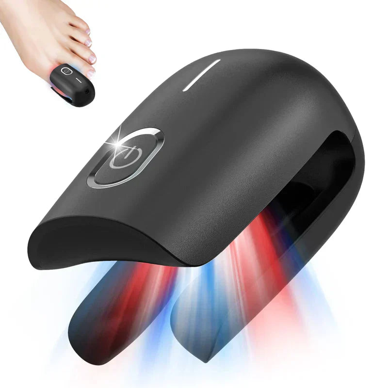 Compact Nail Laser Treatment with USB Recharge - BritishElegance
