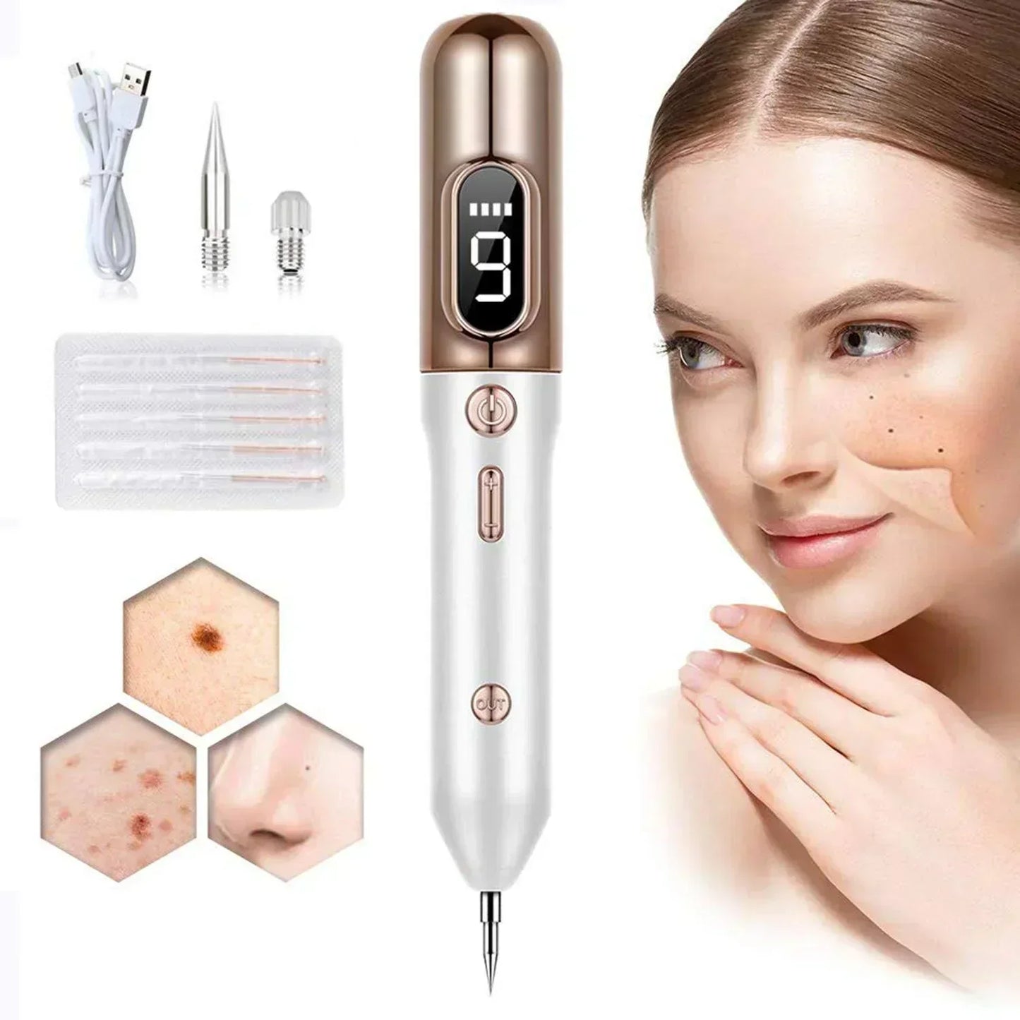 Professional Skin Tag Remover Pen 9 Adjustable Levels - BritishElegance